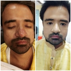 Kutting Hub Unisex Salon & Spa