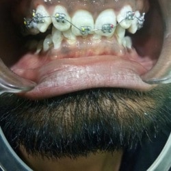 Dr. Bhanus Multispeciality Dental Clinic