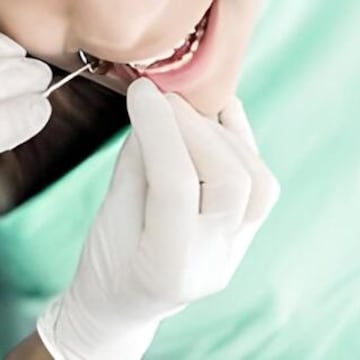 Spark Dental and Implant Center